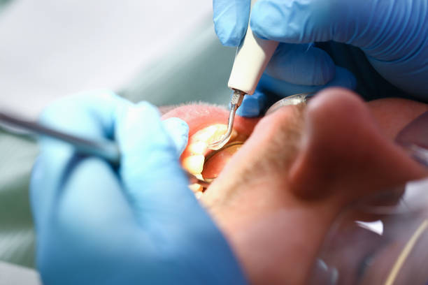 Best Emergency Treatment for Jaw Pain or Injury in Glendale, WI