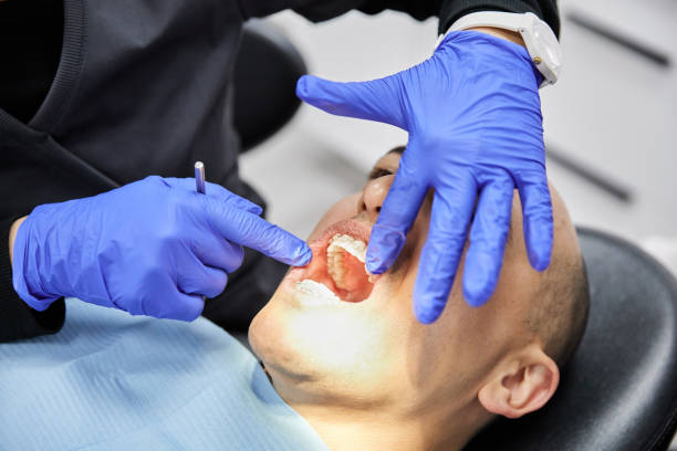 Best Knocked-Out Tooth (Avulsed Tooth) Treatment in Glendale, WI